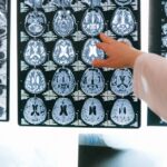 découvrez l'univers de la radiologie, une discipline médicale essentielle pour le diagnostic et le suivi des maladies. informez-vous sur les techniques d'imagerie, les avancées technologiques et l'importance de la radiologie dans le secteur de la santé.