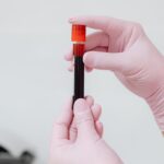 découvrez l'univers du diagnostic in vitro : méthodes, avantages et innovations pour améliorer la détection des maladies et la prise en charge médicale grâce à des tests de laboratoire fiables et rapides.