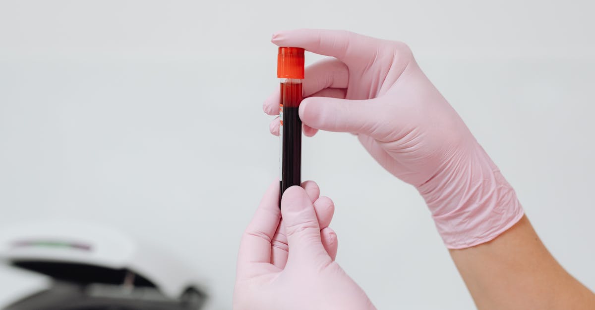 découvrez l'univers du diagnostic in vitro : méthodes, avantages et innovations pour améliorer la détection des maladies et la prise en charge médicale grâce à des tests de laboratoire fiables et rapides.